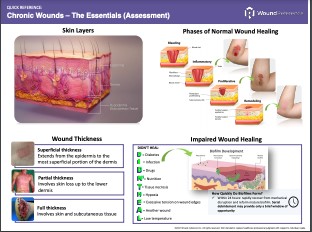 Algorithm Quick Reference Chronic Wounds Essentials Assessment