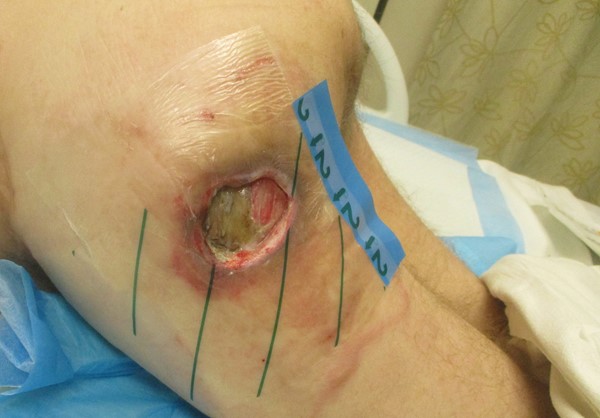 1c. Draping completed