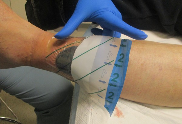 2f. Applying foam and draping over