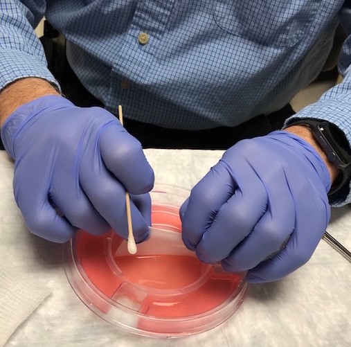 Gently lift CTP from medium with forceps or cotton tip applicator