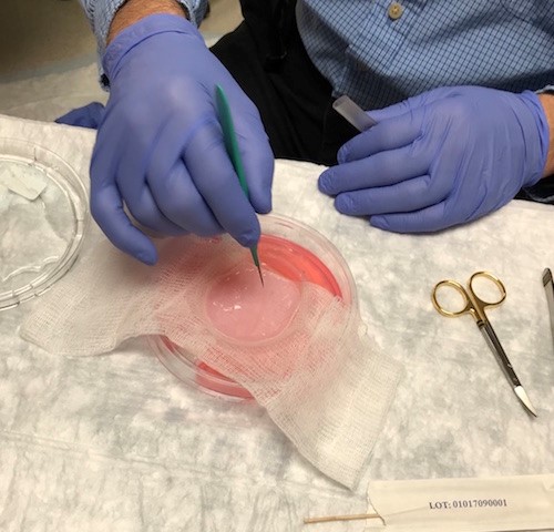  Place gauze with CTP on the CTP dish and fenestrate with a 11 blade scalpel