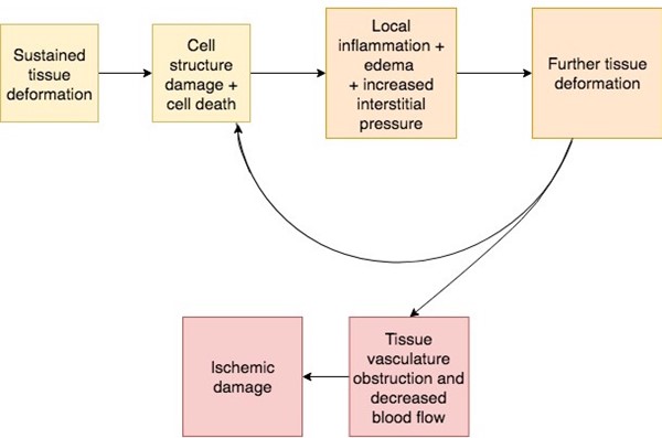 PU/PI damage cascade with direct deformation, inflammatory response, and ischemia