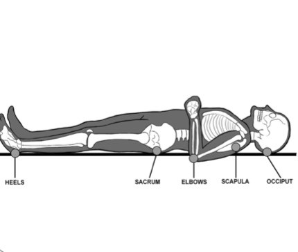 3. Supine position (back) 