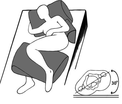 30° lateral tilt position for repositioning