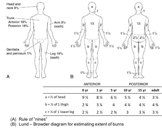 Rule of nines and Lund-Browder diagram. U.S. Department of Health and Human Services [Public domain]