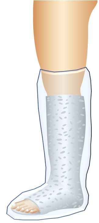 Shower cover for dressings and casts