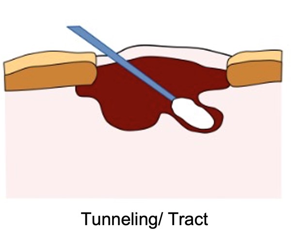 Measuring tunneling