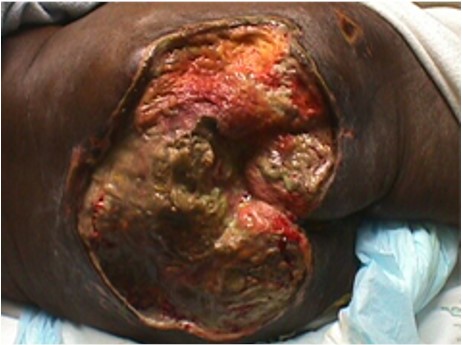 Slough: moist, loose