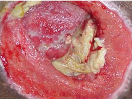 Granulating: pink, red