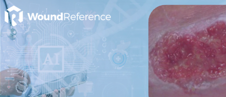 The Promise and Responsibility of AI in Wound Care: Enhancing Clinical Decision-Making